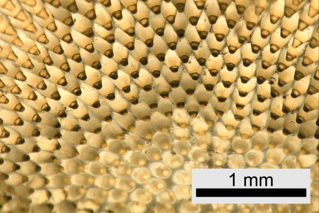A microscopy picture. The picture is filled with tiny yellow structures that look like little cones. Some of them are out of focus, some of them are in focus. Most of them have a dark point inside but in some, the point appears lighter in color.