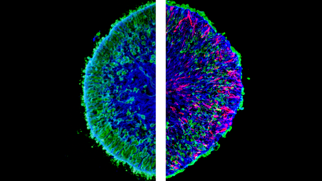 Two microscopy pictures put together. Each part is half of a circle, put together against each other so that they look like a circle. Left: filled with blue color, has a lot of green on the edge. Right: filled with blue, less green, a lot of red strings.