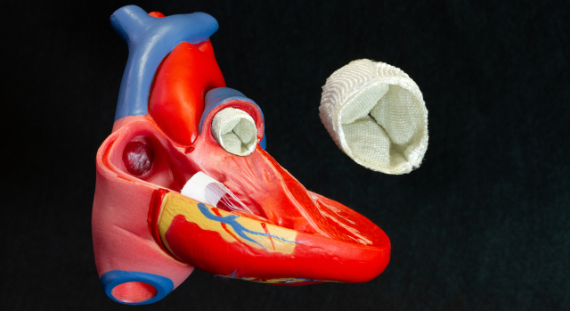 Bild einer gewebten Herzklappe.