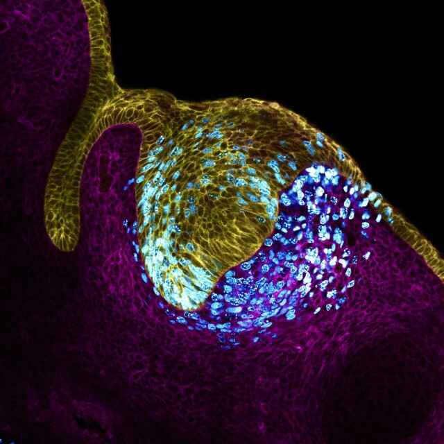 Eine Ansammlung verschiedenfarbiger Zellen bildet in der Mitte einen Schmelzknospe. 